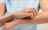 علامات على اليدين قد تكشف الإصابة بالكبد الدهني.. لا تتجاهلها